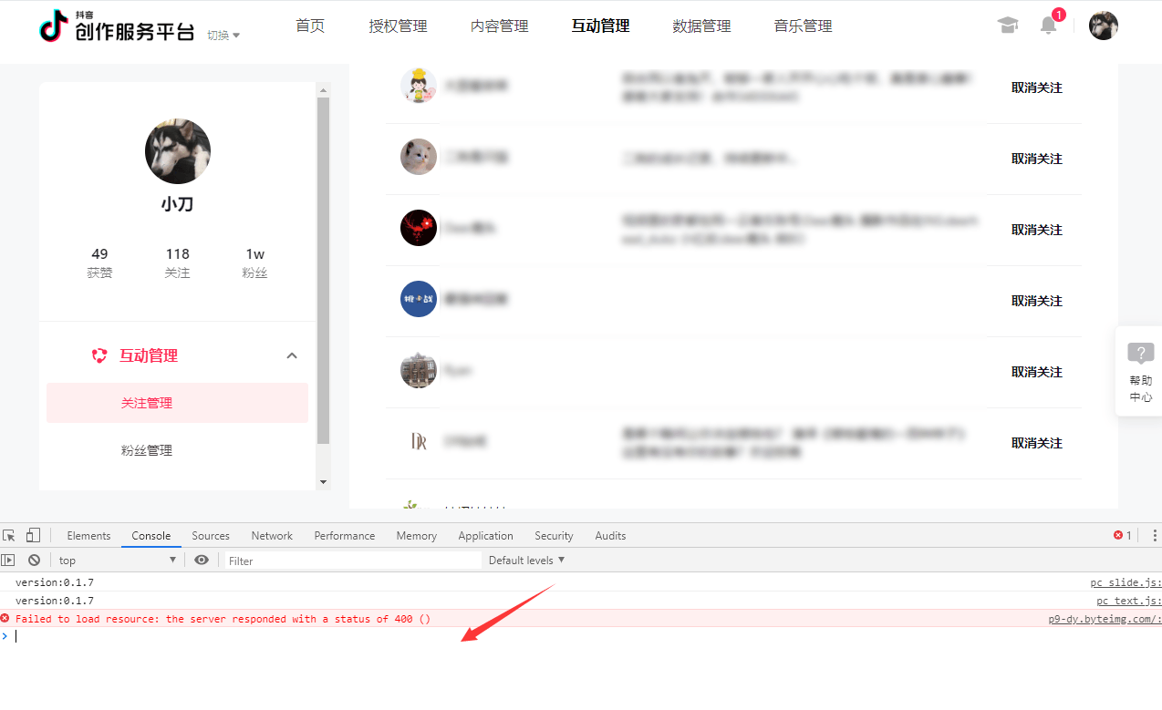 抖音怎么双向取消关注设置权限呢（抖音里什么叫双向关注）
